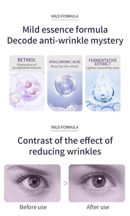 NAYMIA™ Eye Roll-On – Hydratant & Raffermissant